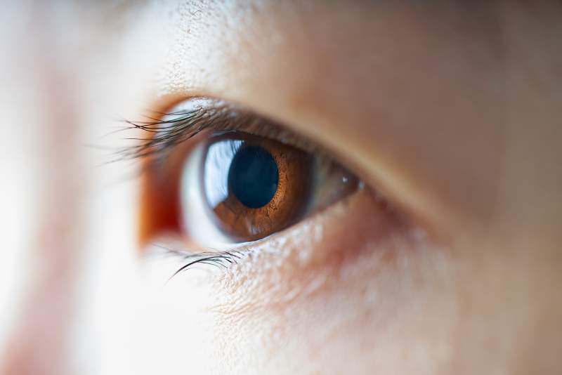 Cómo afecta la neuritis óptica en la esclerosis múltiple a la vista